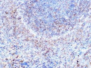 Immunohistochemistry analysis of paraffin-embedded rat spleen using Anti-Moesin Antibody [ARC1258] (A306371) at a dilution of 1:100 (40x lens). Perform microwave antigen retrieval with 10 mM PBS buffer pH 7.2 before commencing with IHC staining protocol.