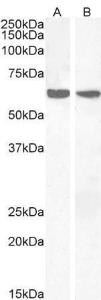 Anti-PPP2R1A Antibody (A84078) (2 µg/ml) staining of Human Thymus (A) and Human Lymph node (B) lysates (35 µg protein in RIPA buffer) Primary incubation was 1 hour Detected by chemiluminescence