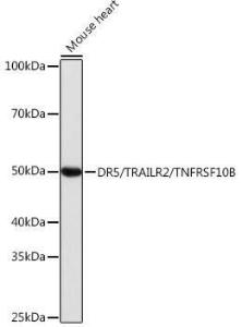 Western blot analysis of extracts of Mouse heart, using Anti-DR5 Antibody [ARC0406] (A305494) at 1:1000 dilution. The secondary Antibody was Goat Anti-Rabbit IgG H&L Antibody (HRP) at 1:10000 dilution