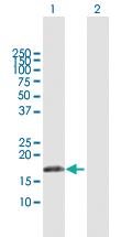 Anti-IFNA17 Rabbit Polyclonal Antibody