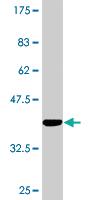 Anti-SIRT3 Mouse Monoclonal Antibody [clone: 1A4]