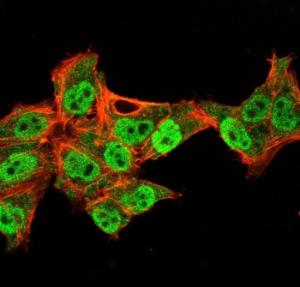 Immunofluorescent analysis of PFA fixed HeLa cells stained with Anti-p40 Antibody [TP40/3980R] followed by Goat Anti-Rabbit IgG (CF&#174; 488) (Green). Membrane labeled with Phalloidin (Red)