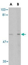 Anti-LGI4 Rabbit Polyclonal Antibody