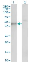 Anti-CSNK1G1 Mouse Monoclonal Antibody [clone: 3D1]