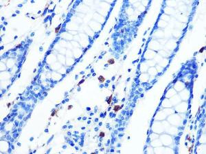 Immunohistochemistry analysis of paraffin-embedded human colon tissue using Anti-Moesin Antibody [ARC1258] (A306371) at a dilution of 1:100 (40x lens). Perform microwave antigen retrieval with 10 mM PBS buffer pH 7.2 before commencing with IHC staining protocol.