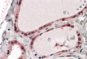 Anti-PPP2R1A Antibody (A84078) (375 µg/ml) staining of paraffin embedded Human Thyroid Gland Steamed antigen retrieval with citrate buffer pH 6, AP-staining