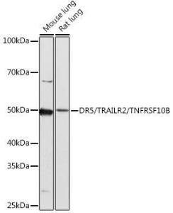 Western blot analysis of extracts of various cell lines, using Anti-DR5 Antibody [ARC0406] (A305494) at 1:1000 dilution. The secondary Antibody was Goat Anti-Rabbit IgG H&L Antibody (HRP) at 1:10000 dilution