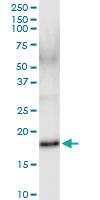 Anti-IFNA17 Rabbit Polyclonal Antibody