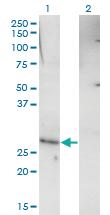 Anti-RHOXF1 Mouse Monoclonal Antibody [clone: 4D12]