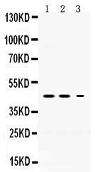 Anti-SERPINI1 Rabbit Polyclonal Antibody