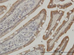 Anti-CSNK1G1 Mouse Monoclonal Antibody [clone: 3D1]