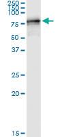 Anti-NARS Polyclonal Antibody Pair