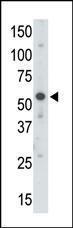 Anti-UBA3 Rabbit Polyclonal Antibody (Biotin)