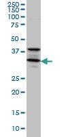 Anti-STX5 Mouse Monoclonal Antibody [clone: 5A6]