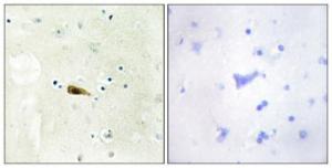 Immunohistochemical analysis of paraffin-embedded human brain tissue using Anti-MYST1 Antibody. The right hand panel represents a negative control, where the antibody was pre-incubated with the immunising peptide.