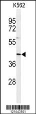 Anti-IN80B Rabbit Polyclonal Antibody