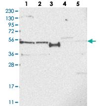 Anti-SLCO4A1 Rabbit Polyclonal Antibody