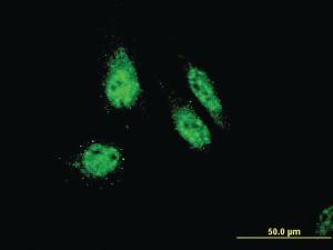 Anti-RHOXF1 Mouse Monoclonal Antibody [clone: 4D12]