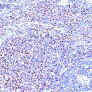 Immunohistochemistry analysis of paraffin-embedded rat spleen using Anti-TC10 Antibody [ARC2309] (A306373) at a dilution of 1:100 (40x lens) Perform microwave antigen retrieval with 10 mM Tris/EDTA buffer pH 90 before commencing with IHC staining protocol