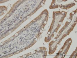 Anti-CSNK1G1 Mouse Monoclonal Antibody [clone: 3D1]