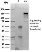 SDS-PAGE analysis of Anti-Cytokeratin 14 Antibody [KRT14/4133] under non-reduced and reduced conditions; showing intact IgG and intact heavy and light chains, respectively. SDS-PAGE analysis confirms the integrity and purity of the antibody