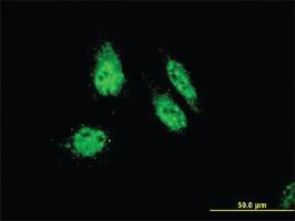 Anti-RHOXF1 Mouse Monoclonal Antibody [clone: 4D12]