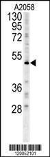 Anti-FOXC2 Rabbit Polyclonal Antibody (FITC (Fluorescein Isothiocyanate))