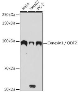 Western blot analysis of extracts of various cell lines, using Anti-Cenexin1 / ODF2 Antibody [ARC2057] (A306375) at 1:1,000 dilution. The secondary antibody was Goat Anti-Rabbit IgG H&L Antibody (HRP) at 1:10,000 dilution.