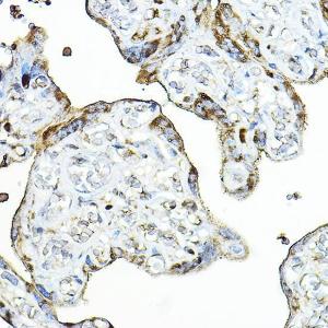 Immunohistochemistry analysis of paraffin-embedded human placenta using Anti-PRG2 Antibody (A11539) at a dilution of 1:100 (40x lens) Perform high pressure antigen retrieval with 10 mM citrate buffer pH 60 before commencing with IHC staining protocol