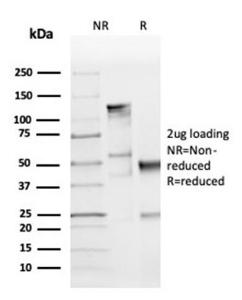 SDS-PAGE analysis of Anti-Cyclin D1 Antibody [CCND1/3370R] under non-reduced and reduced conditions; showing intact IgG and intact heavy and light chains, respectively. SDS-PAGE analysis confirms the integrity and purity of the antibody