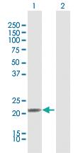 Anti-IFNA21 Rabbit Polyclonal Antibody