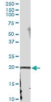 Anti-IFNA21 Rabbit Polyclonal Antibody