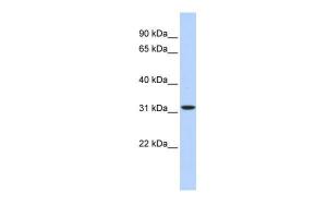 Anti-HIBADH Rabbit Polyclonal Antibody