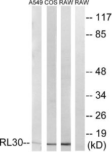 Antibody anti-RPL30 100 µg