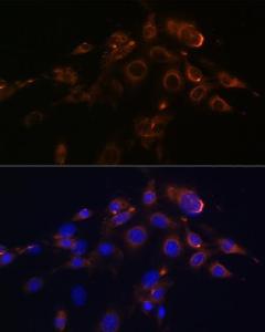 Immunofluorescence analysis of NIH-3T3 cells using Anti-DR5 Antibody [ARC0406] (A305494) at a dilution of 1:100 (40X lens). DAPI was used to stain the cell nuclei (blue)