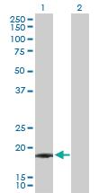 Anti-IFNA21 Rabbit Polyclonal Antibody