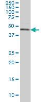 Anti-CSNK1G1 Mouse Monoclonal Antibody [clone: 2E10]