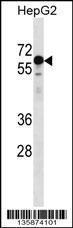 Anti-KLHL25 Rabbit Polyclonal Antibody (AP (Alkaline Phosphatase))