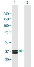 Anti-APOA5 Mouse Polyclonal Antibody