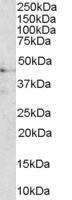 Anti-MC3R Antibody (A84081) (1µg/ml) staining of Human Brain lysate (35µg protein in RIPA buffer). Primary incubation was 1 hour. Detected by chemiluminescence.