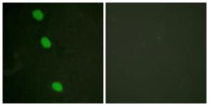 Immunofluorescence analysis of HeLa cells using Anti-CaMK4 (phospho Thr196 + Thr200) Antibody. The right hand panel represents a negative control, where the antibody was pre-incubated with the immunising peptide