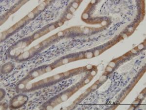 Anti-CSNK1G1 Mouse Monoclonal Antibody [clone: 2E10]