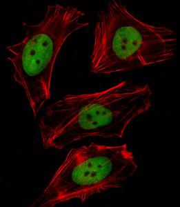 Anti-FOXD1 Rabbit Polyclonal Antibody (Biotin)