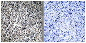 Immunohistochemical analysis of paraffin-embedded human lymph node tissue using Anti-MPRIP Antibody. The right hand panel represents a negative control, where the Antibody was pre-incubated with the immunising peptide