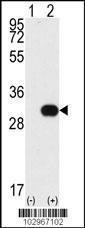 Anti-NEK7 Rabbit Polyclonal Antibody (Biotin)