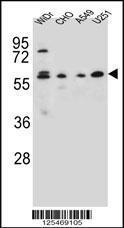 Anti-CEP70 Rabbit Polyclonal Antibody