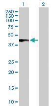 Anti-IFNAR2 Rabbit Polyclonal Antibody