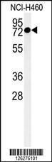 Anti-CCDC62 Rabbit Polyclonal Antibody (APC (Allophycocyanin))