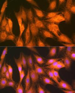 Immunofluorescence analysis of C6 cells using Anti-FAT10 Antibody [ARC1379] (A306378) at a dilution of 1:100 (40x lens). DAPI was used to stain the cell nuclei (blue).