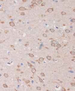 Immunohistochemistry analysis of paraffin-embedded rat brain using Anti-STIM2 Antibody (A305495) at a dilution of 1:100 (40X lens). Perform microwave antigen retrieval with 10 mM PBS buffer pH 7.2 before commencing with IHC staining protocol